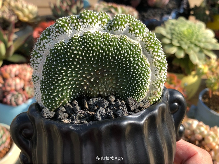 beat·365|少女月经不调 该不该做妇科检查？