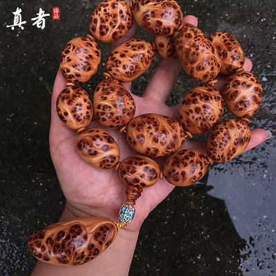 beat365亚洲体育官方网站-诱发霉菌性阴道炎的病因有哪些(图1) beat·365
